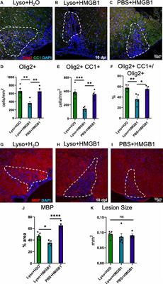 The Cellular Senescence Factor Extracellular HMGB1 Directly Inhibits Oligodendrocyte Progenitor Cell Differentiation and Impairs CNS Remyelination